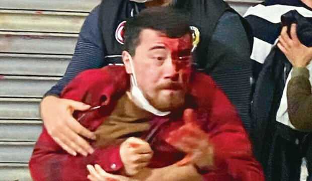 Dehşet anlarını anlattı: Polis bunlar öldürün...