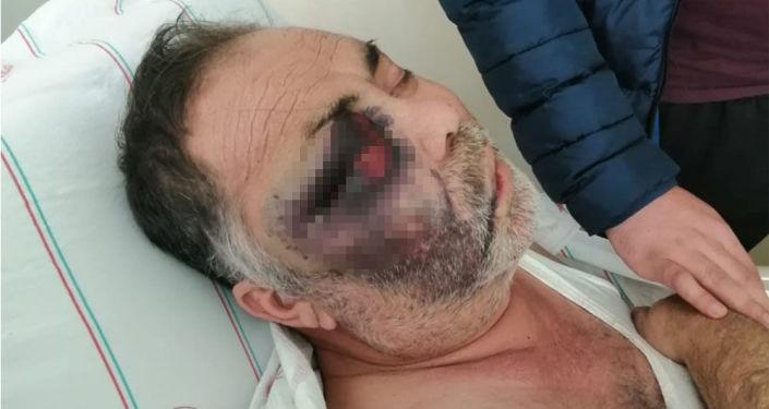 Yüzde 90 engelli kişiye darp iddiasında 2 şüpheli tekrar gözaltına alındı