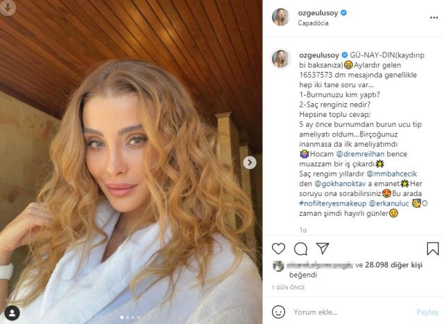 Değişimiyle çok konuşulan Özge Ulusoy, ilk estetik ameliyatını yaptırdı