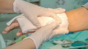 Yanığa ne iyi gelir? Yanık dereceleri nelerdir?