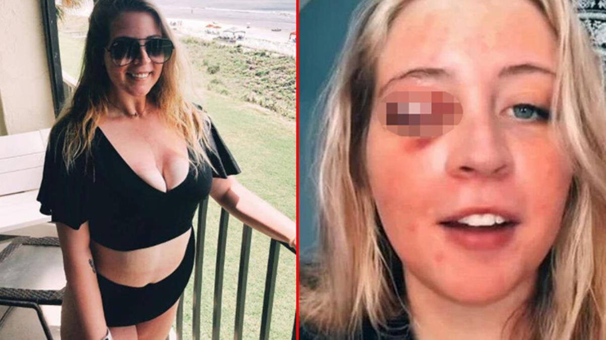 Güzelleşmek için gittiği salondan kanlar içerisinde çıktı! Köpek, göz kapağını kopardı