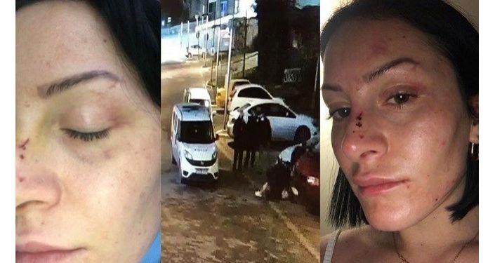 Polis tarafından dövüldüğü gerekçesiyle şikayette bulunan Gökçe Yaşar: Doktor 'Bunu az benzetmişsiniz' dedi