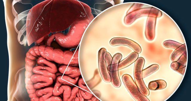 Kolera nedir? Kolera salgını belirtileri nelerdir? Kolera hastalığı nasıl bulaşır? Kolera tedavisi var mı?