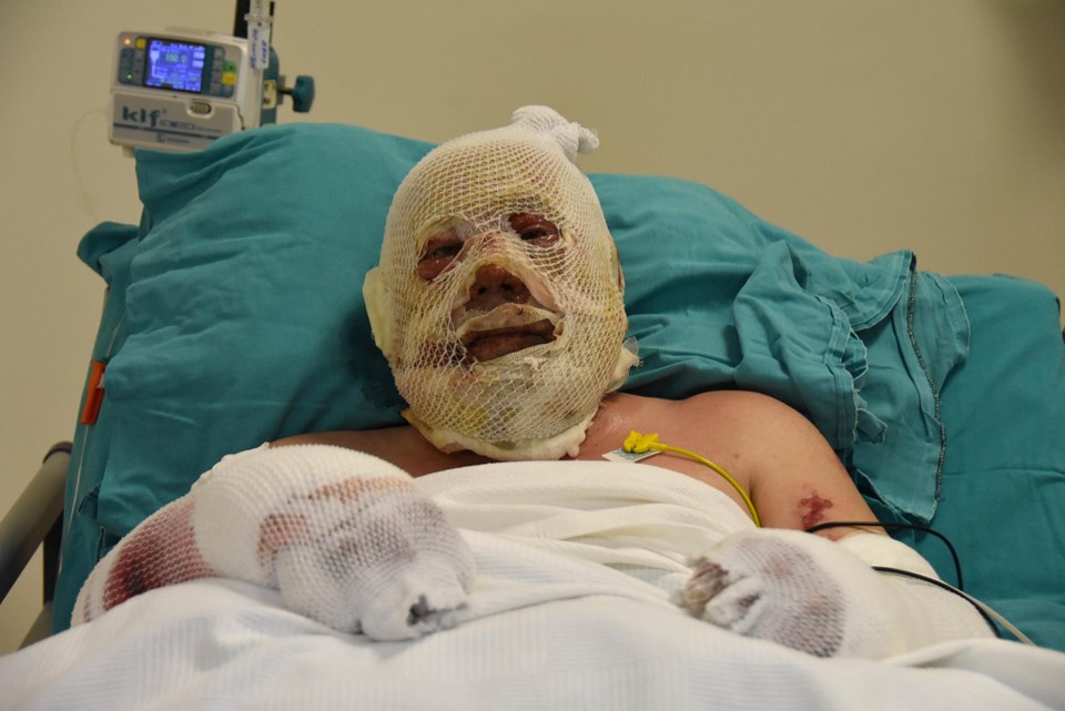 Denizli'deki orman yangınında alevlerin arasında kalan Yaşar Kozakbaş, yaşadıklarını anlattı