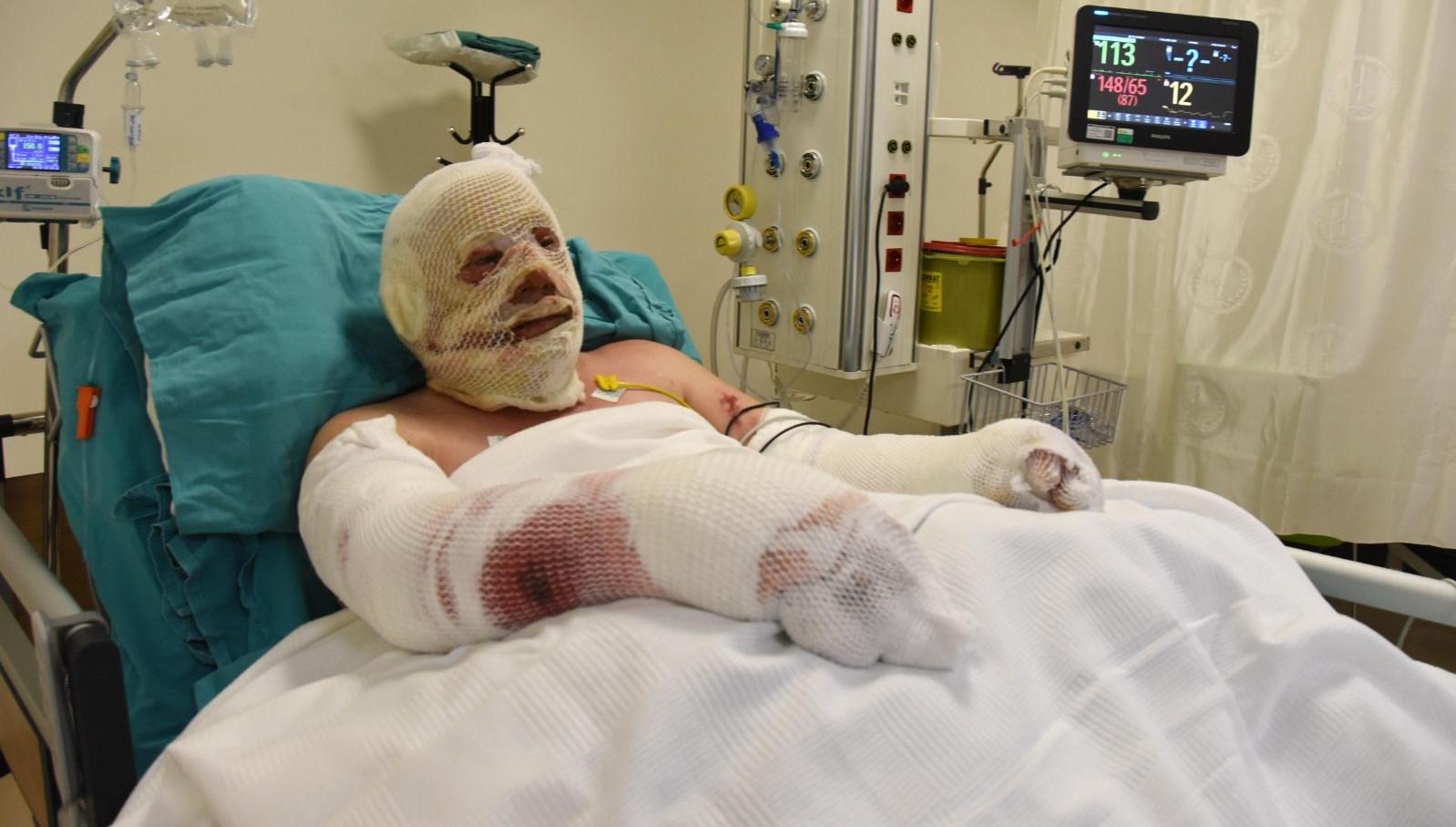 Denizli&#039;deki orman yangınında alevlerin arasında kalan Yaşar Kozakbaş, yaşadıklarını anlattı