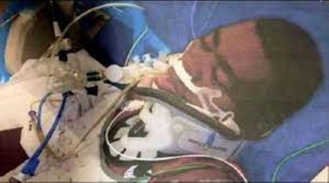 Hatalı anestezi yüzünden 1982'den beri komada yatan Fransız futbolcu Adams, hayatını kaybetti