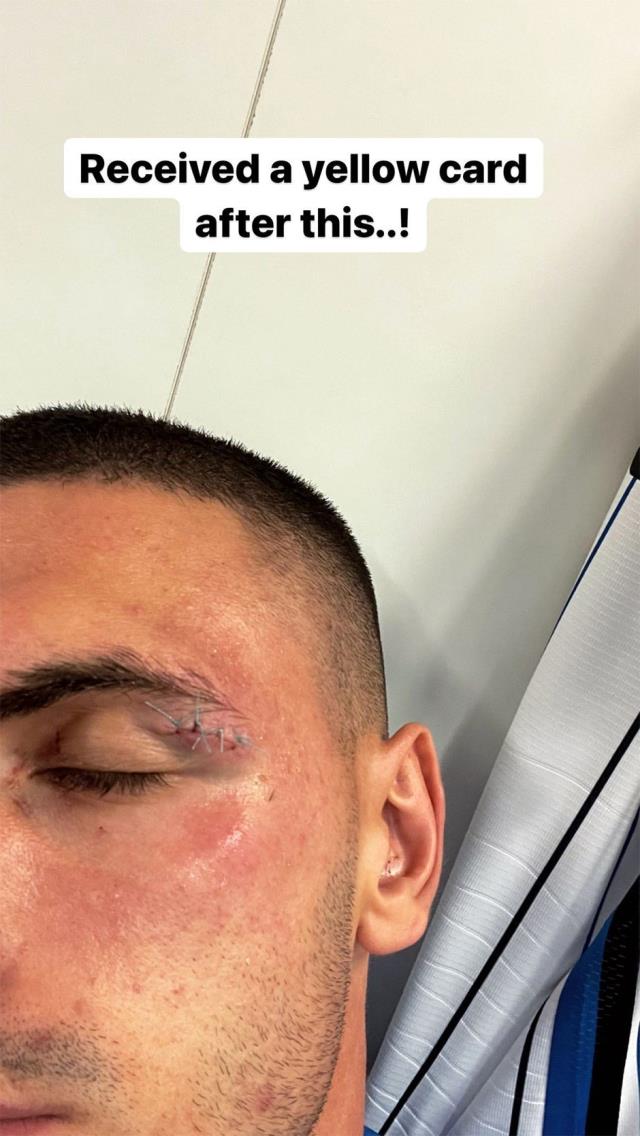 Kanlar içinde kalan Merih Demiral, bir de sarı kart gördü! Milli futbolcumuzdan isyan paylaşımı