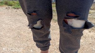 Başkent Ankara'da Başıboş Köpeklerin Saldırısına Uğrayan Kadın  Canını Zor Kurtardı!