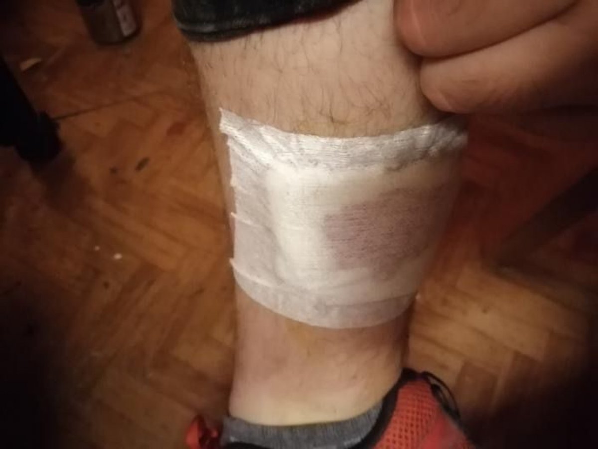 Antalya’da kızına balon almak için yürürken köpek saldırdı