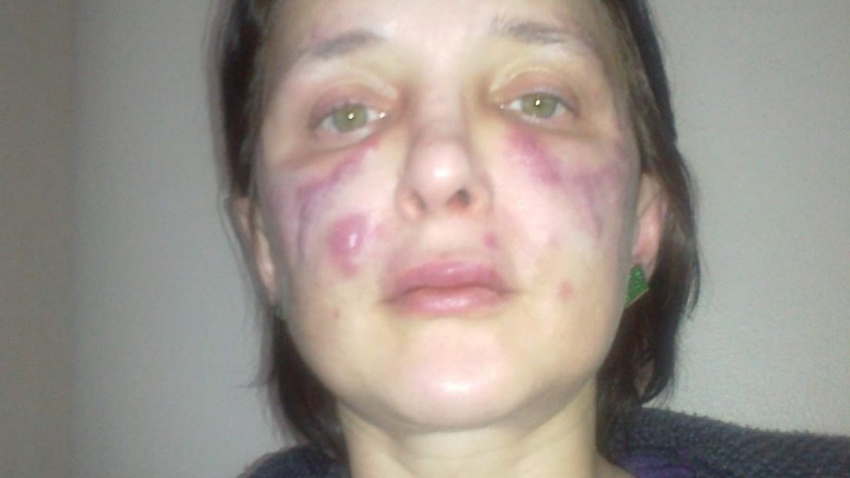 Bakırköy’de kadını tanınmaz hale getiren sahte doktora 3 yıl 4 ay ceza