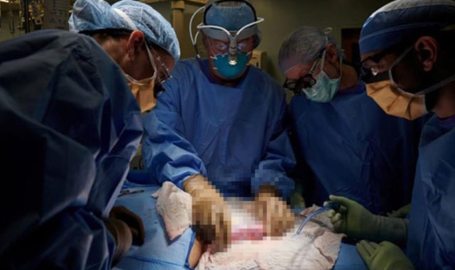 Herkesin gözü bu ameliyattaydı! İşte domuz böbreğinin ölü insana nakil işleminin ilk sonuçları