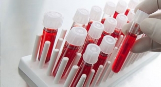 İngiltere'de kan grupları üzerine bir araştırma yapıldı