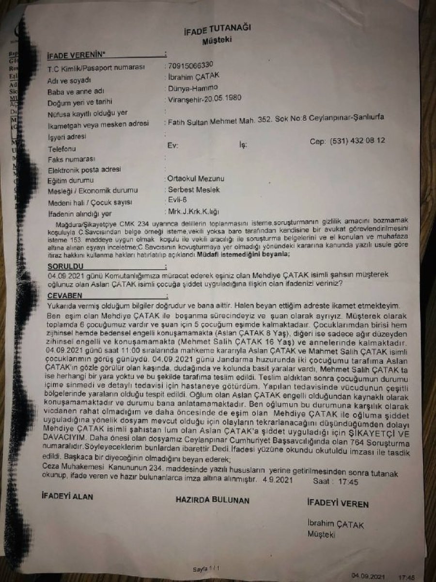 Şanlıurfa'daki adam engelli oğluna işkence eden eşinden şikayetçi