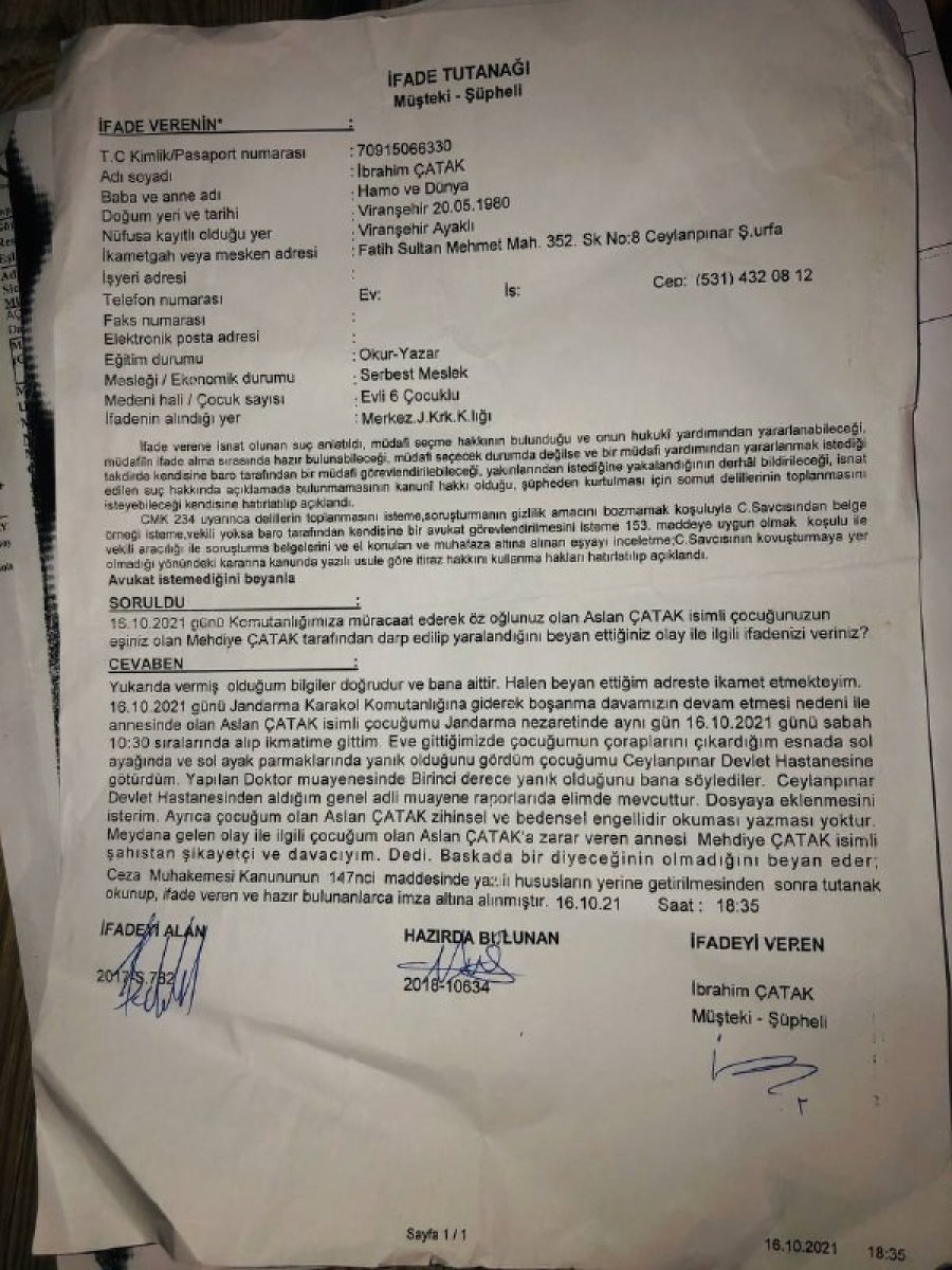 Şanlıurfa'daki adam engelli oğluna işkence eden eşinden şikayetçi