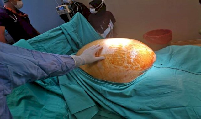 Tümör alınınca 91 kilodan 70 kiloya düştü