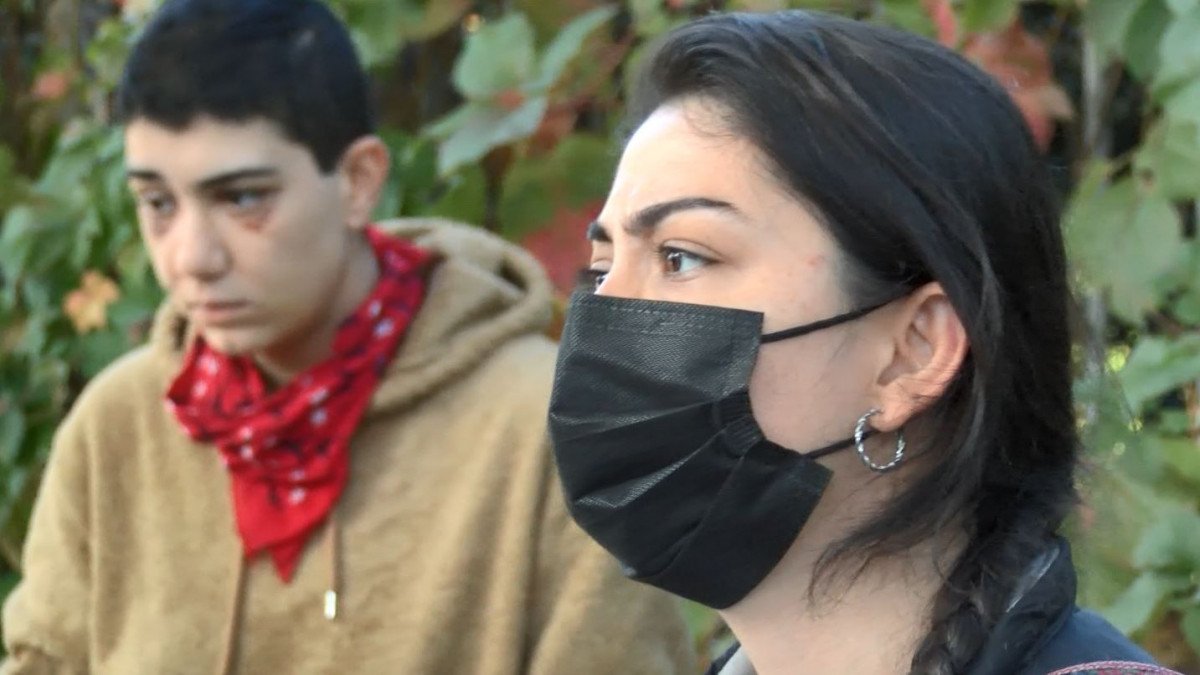 Beyoğlu'nda saldırı sonrası yüzü kısmi felç oldu