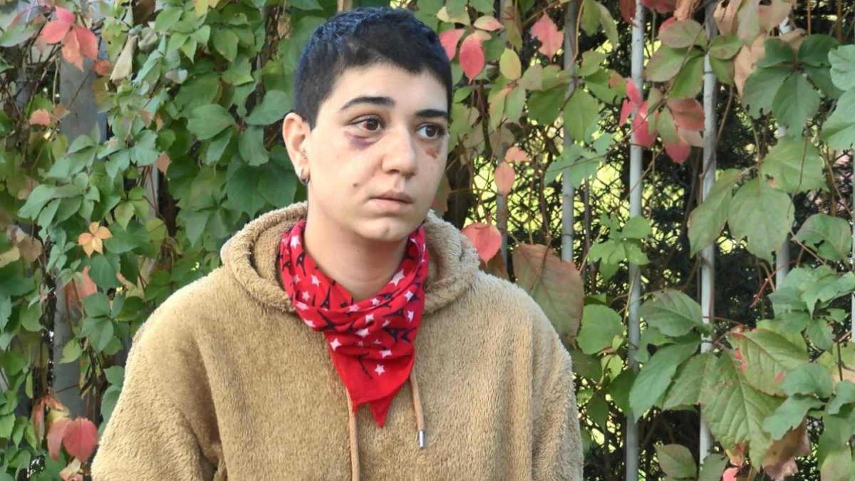 Beyoğlu'nda saldırı sonrası yüzü kısmi felç oldu