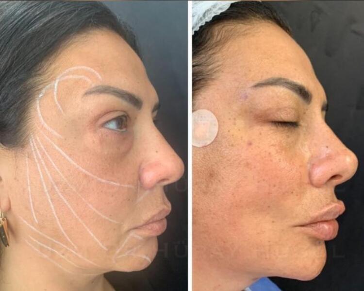 ‘Çok Hoş Hareketler Bunlar’ ile tanınan Zeynep Koçak'ın şaşırtan değişimi