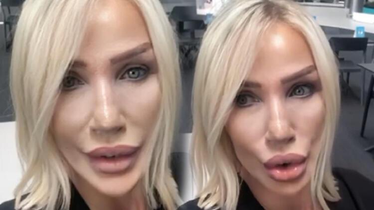 Demet Özdemir'den iddialara yanıt: Bugün estetiği fazla kaçırdım