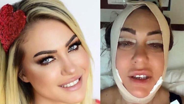 Demet Özdemir'den iddialara yanıt: Bugün estetiği fazla kaçırdım