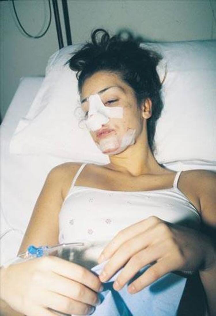 Demet Özdemir'den iddialara yanıt: Bugün estetiği fazla kaçırdım