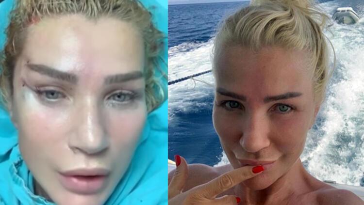 Demet Özdemir'den iddialara yanıt: Bugün estetiği fazla kaçırdım