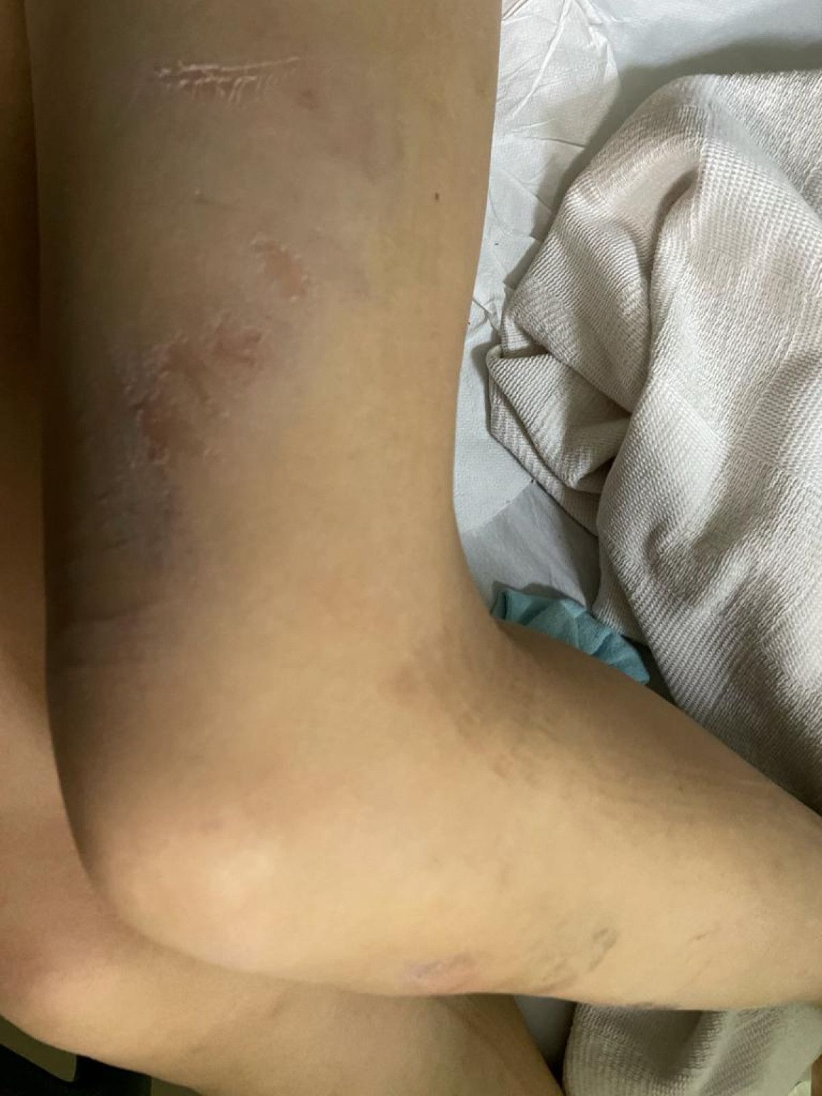 Fatih'teki otoparkçı hatasında, sürücünün karnı yırtıldı