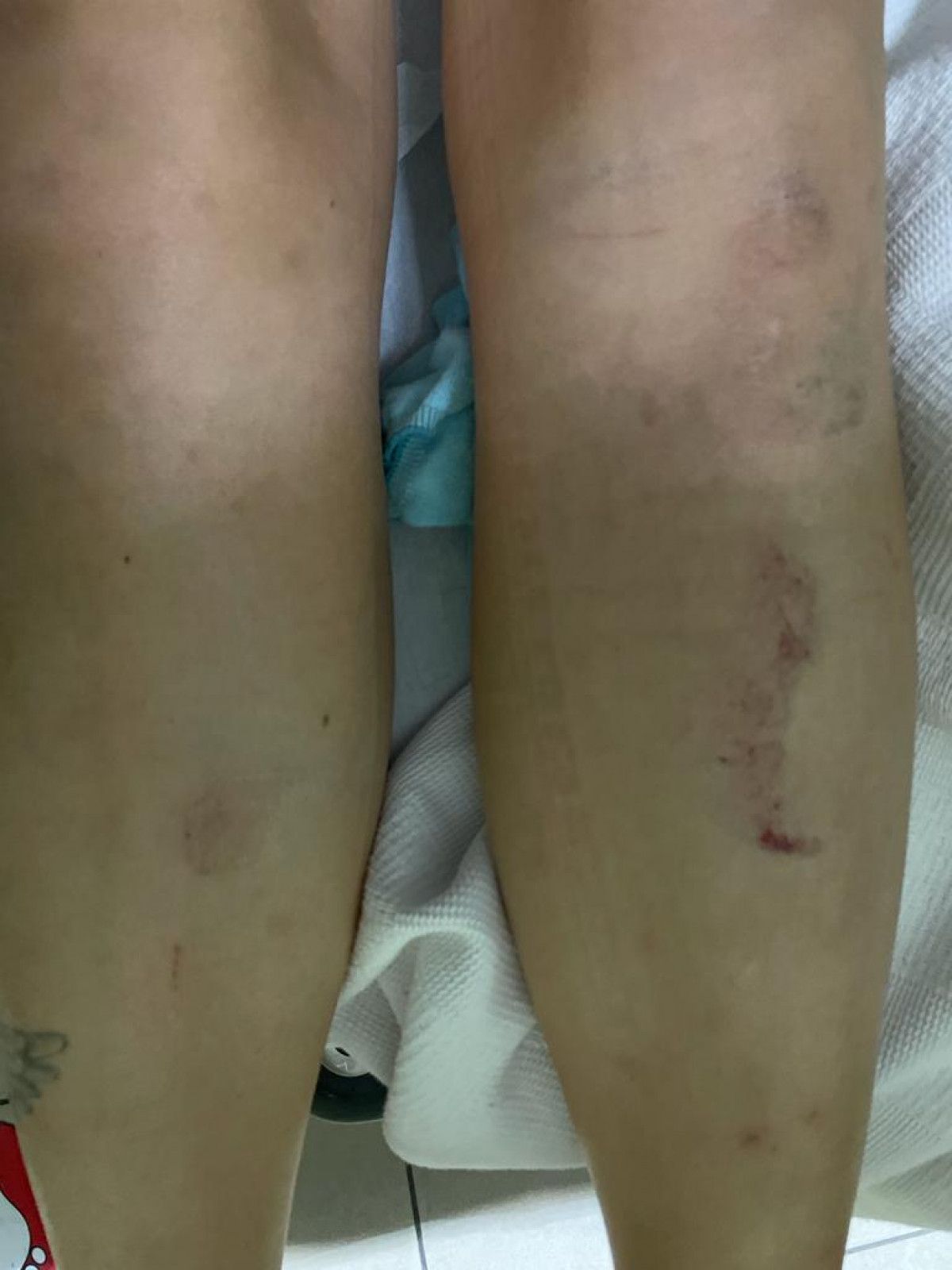 Fatih'teki otoparkçı hatasında, sürücünün karnı yırtıldı