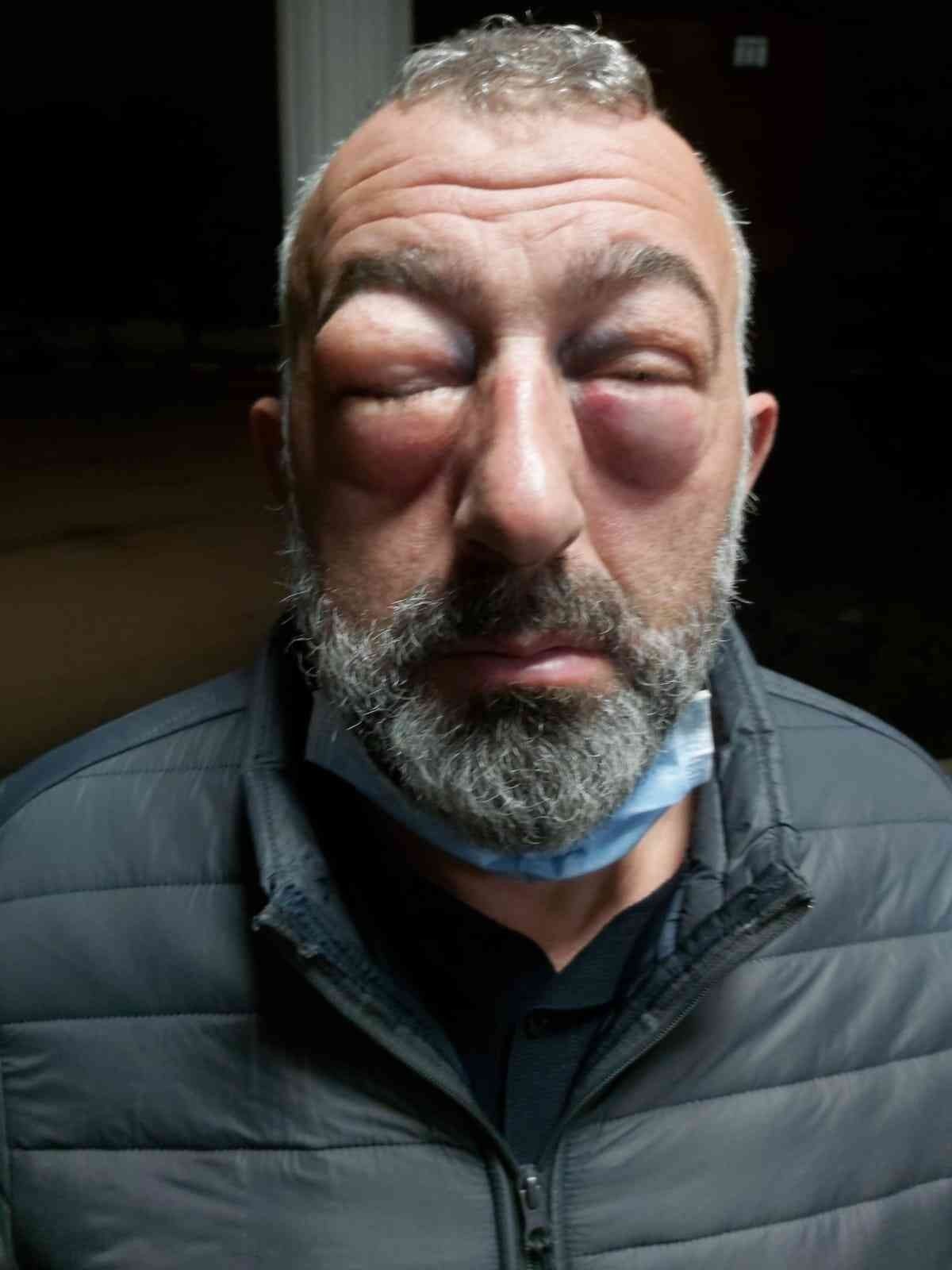 Kocaeli'de otobüs şoförleri yolcuyu darbetti