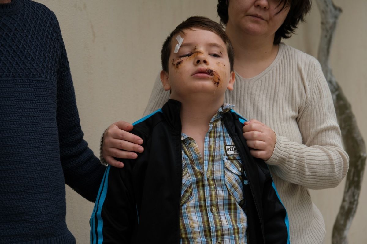 Manisa'daki sokak köpeği çocuğa saldırdı