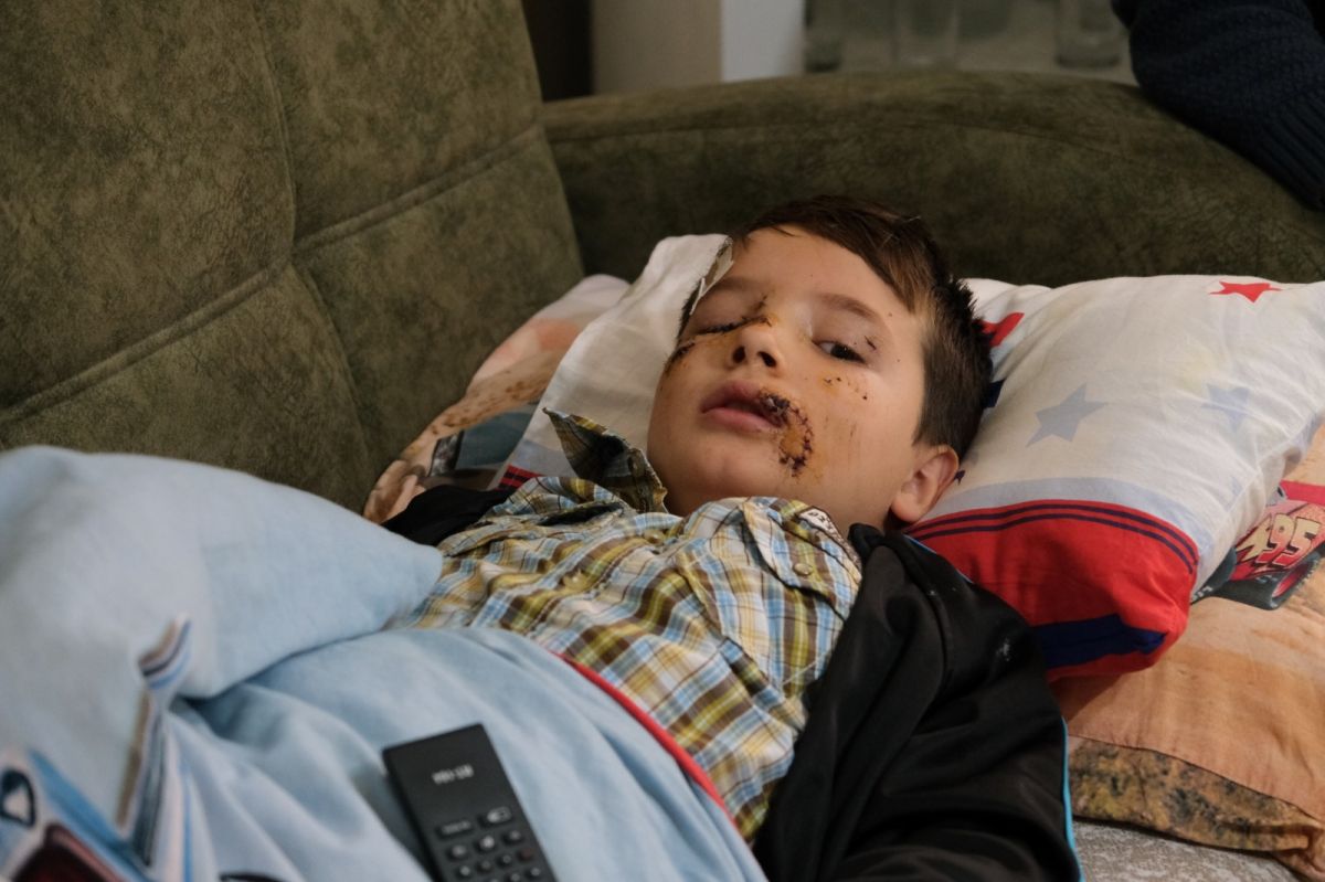 Manisa'daki sokak köpeği çocuğa saldırdı