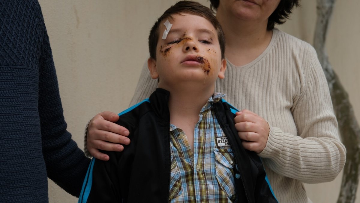 Manisa'daki sokak köpeği çocuğa saldırdı