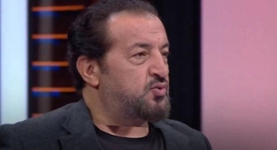 MasterChef Türkiye'nin sevilen jüri üyesi Mehmet Yalçınkaya  dudaklarına estetik yaptırdığı iddiasına sitem etti!