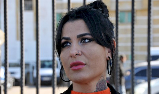 Antalya'da lazerde yüzü yanan kadının davasında sonuç çıktı