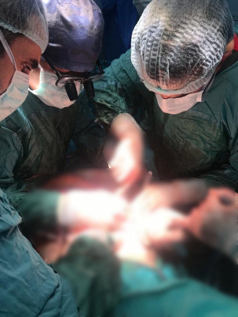 Van’da kilo zannetti, karnından 35 kiloluk tümör çıkarıldı