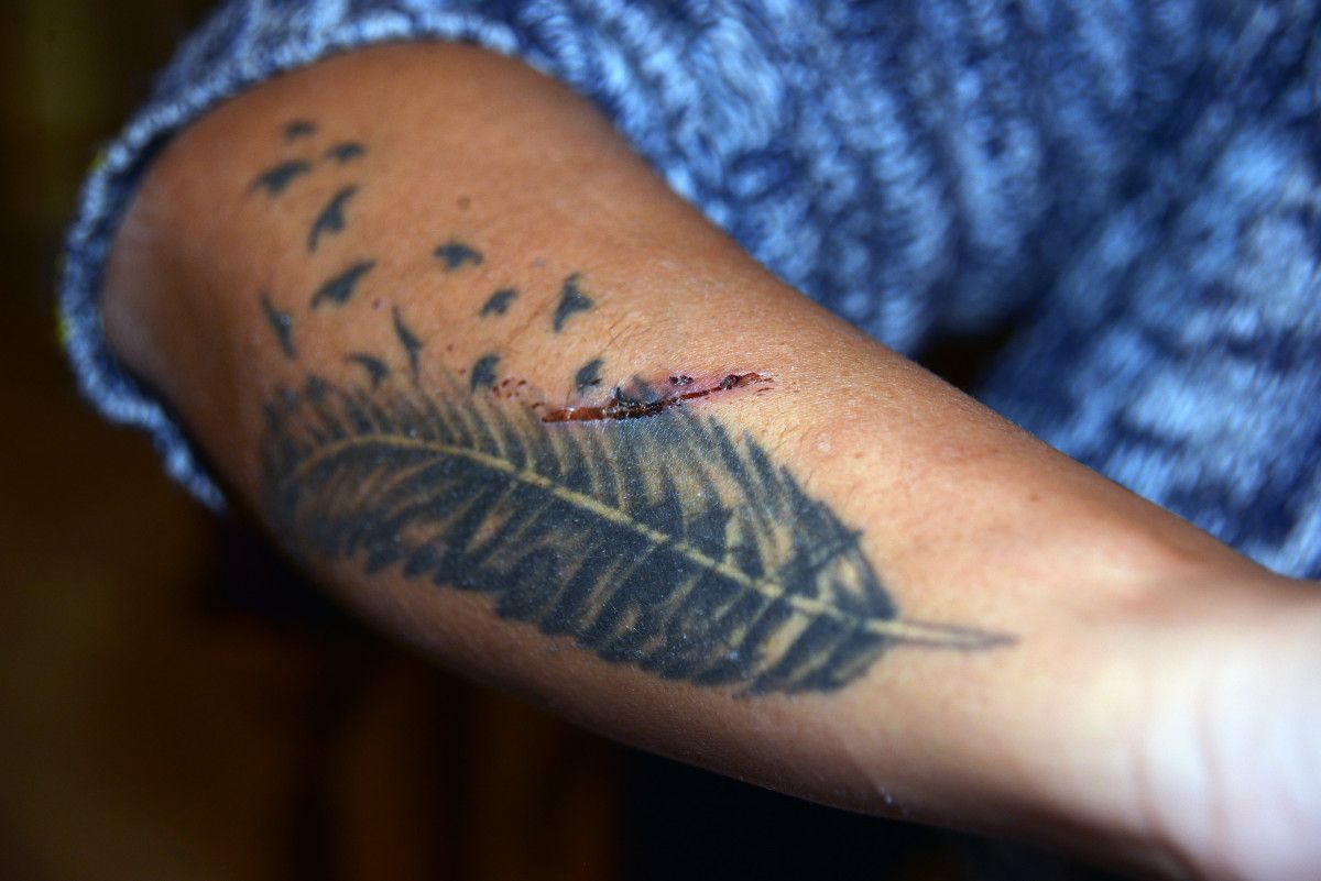 Adana'da eski sevgilisi, bu kez de yüzünü usturayla kesti