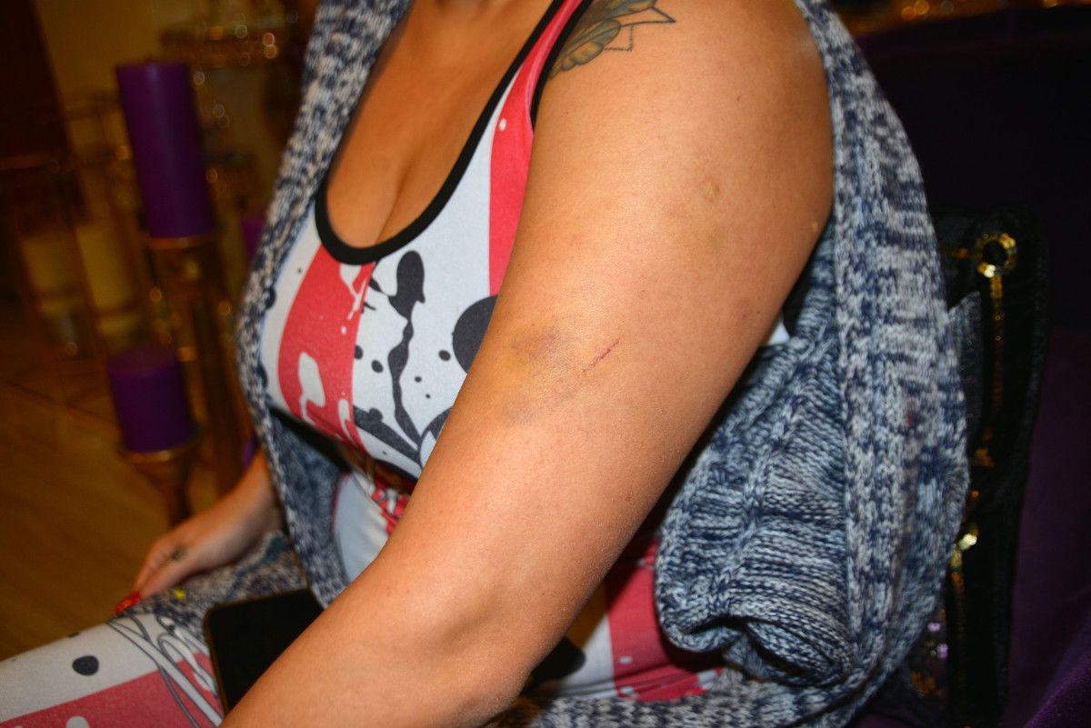 Adana'da eski sevgilisi, bu kez de yüzünü usturayla kesti