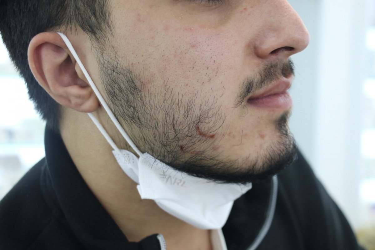 Ankara'da saldırıya uğrayan eczacı konuştu