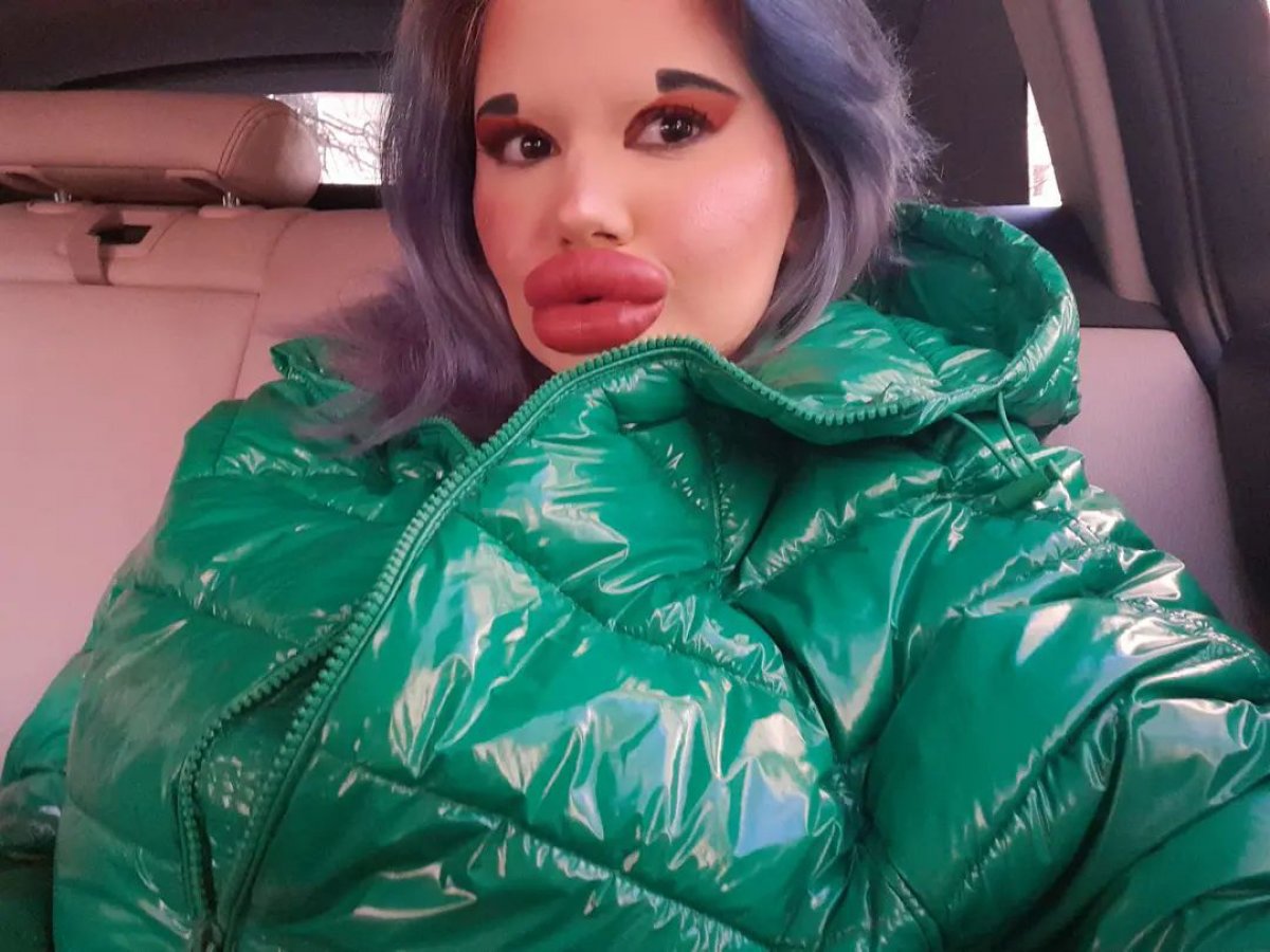 Dünyanın en büyük dudaklı kadını Andrea Ivanova, hedefini açıkladı