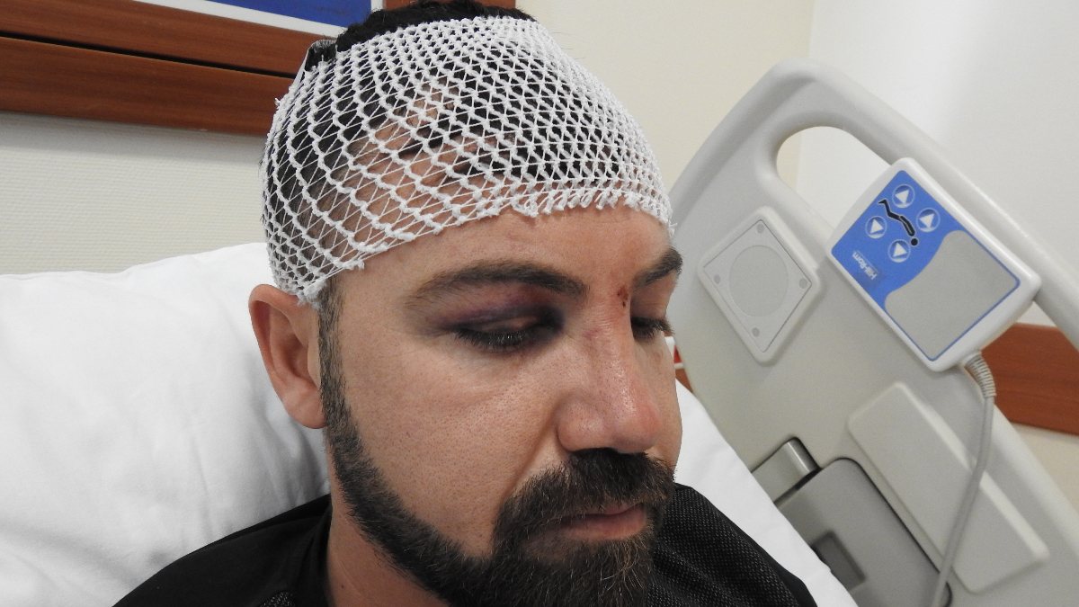 Gaziantep&#039;te 15 kişinin saldırdığı genç beyin kanaması geçirdi