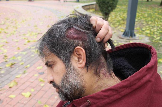 Gitmediği yer kalmadı, 12 yıldır teşhis konulamıyor!