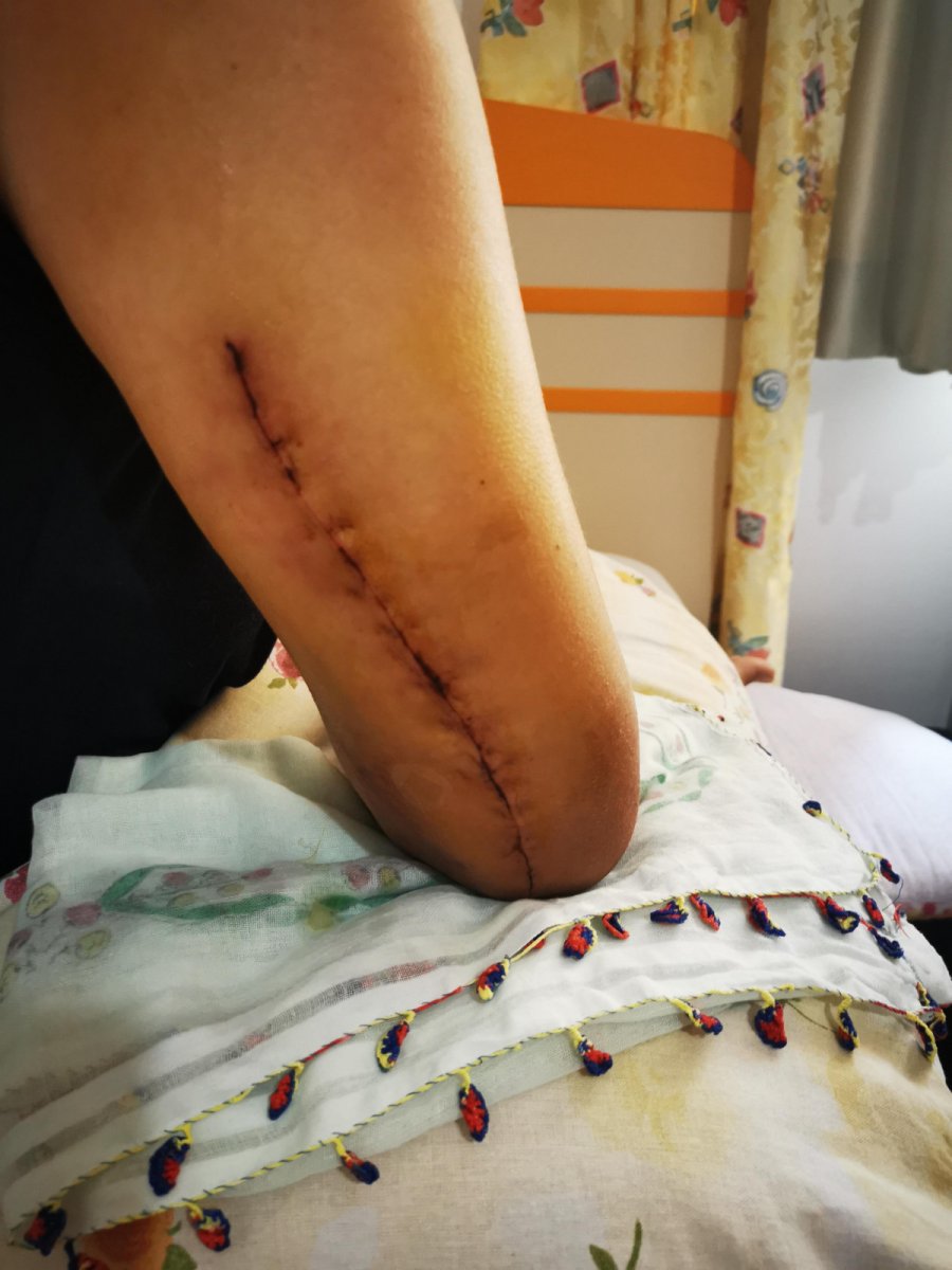 İzmir'de sevgilisinin kolunu kıran sanığa indirimli ceza