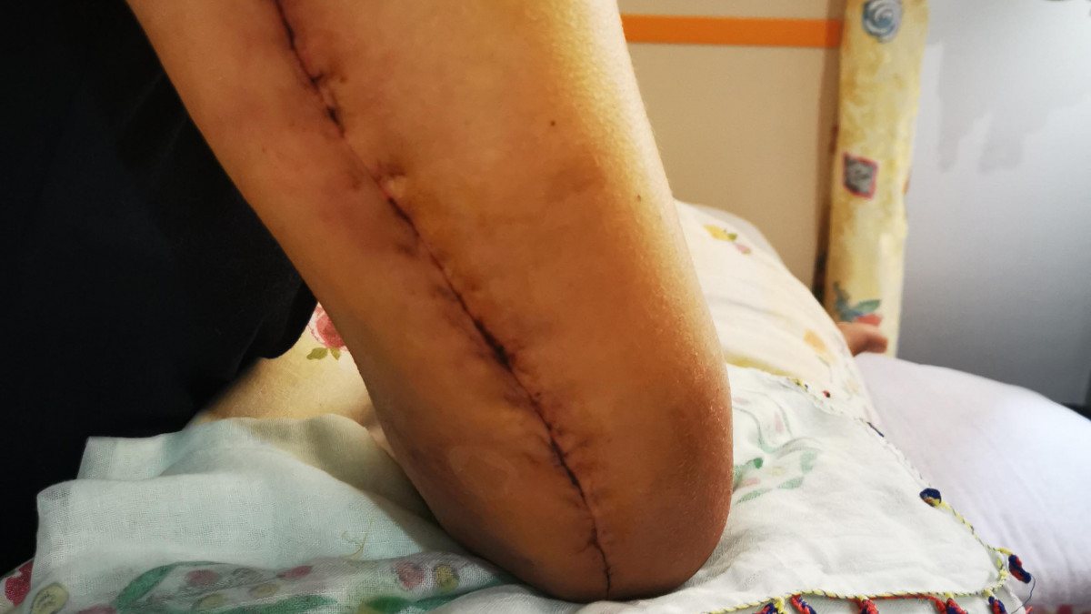 İzmir&#039;de sevgilisinin kolunu kıran sanığa indirimli ceza