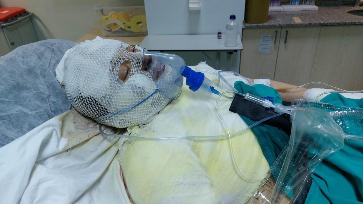 Ordu'da cani adam eski eşini yaktı