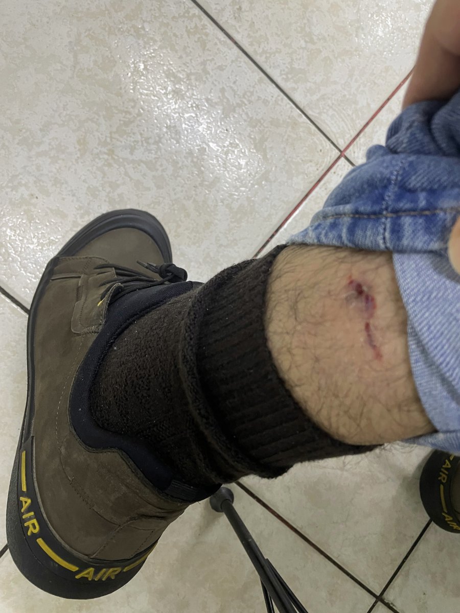 Sakarya'da işe giderken köpeklerin saldırısına uğradı