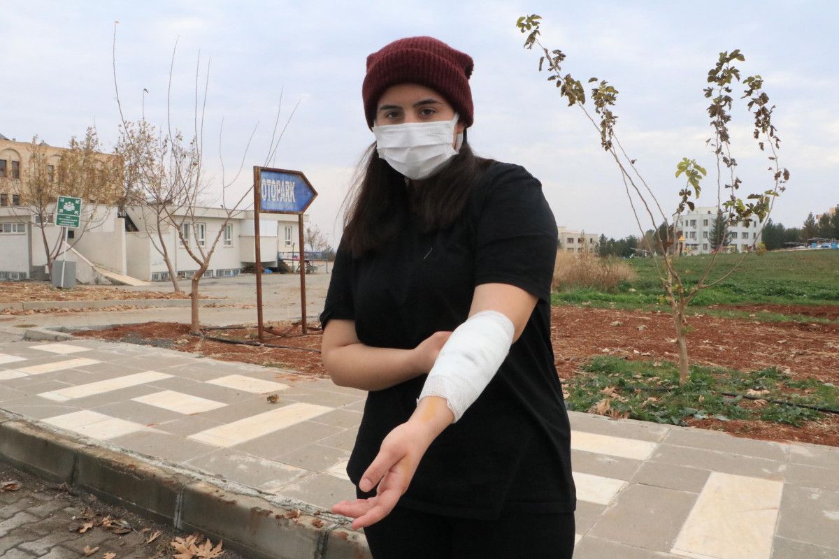 Şanlıurfa'daki üniversite kampüsünde köpek dehşeti