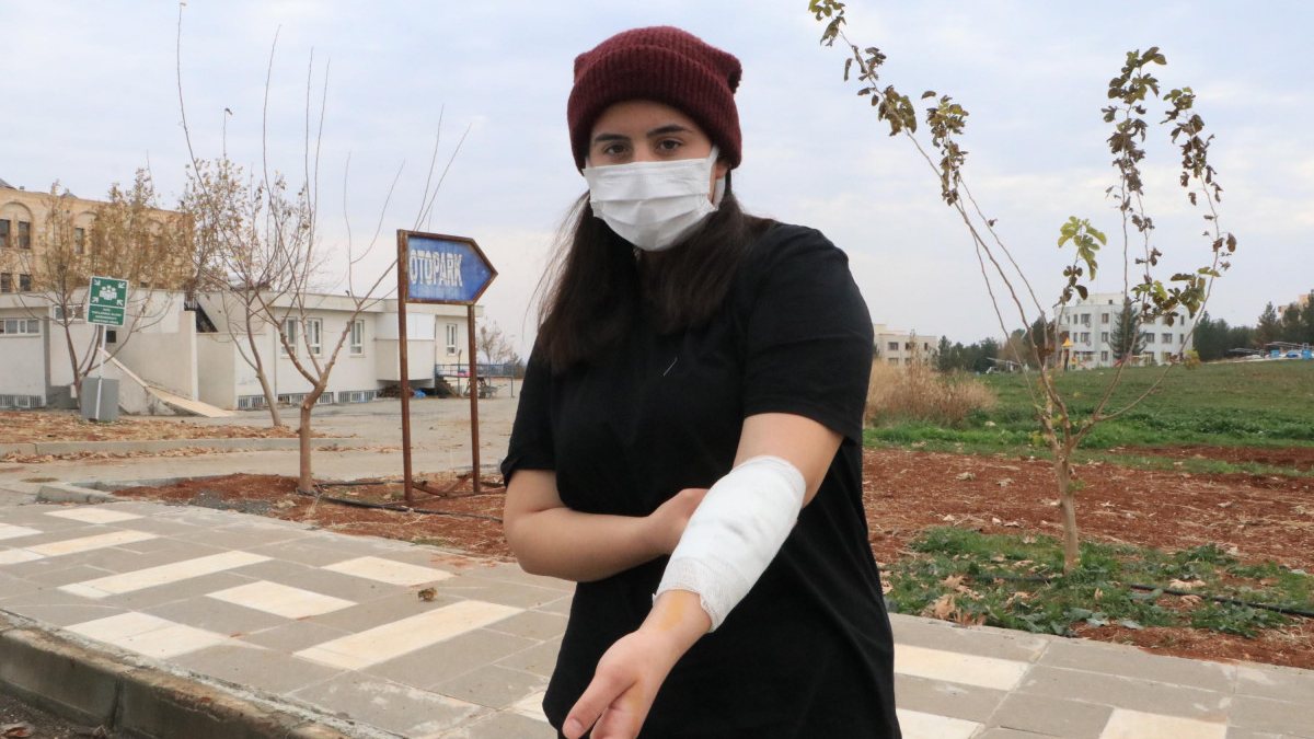 Şanlıurfa&#039;daki üniversite kampüsünde köpek dehşeti