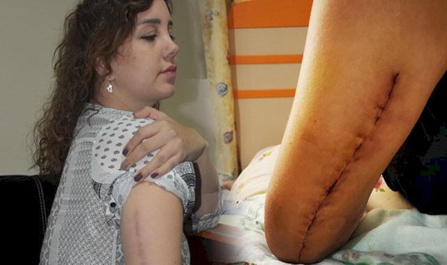 Sevgilisinin kolunu kıran sanığa tahrik ve iyi hal indirimi! 'Tek başıma sokağa çıkamıyorum'