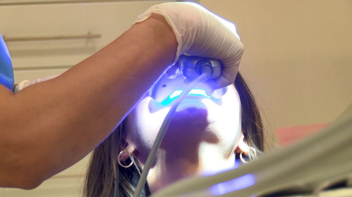 Sosyal Medya Üzerinden Bir Tehlikeli Akım Daha! "DİŞ BEYAZLATMA"