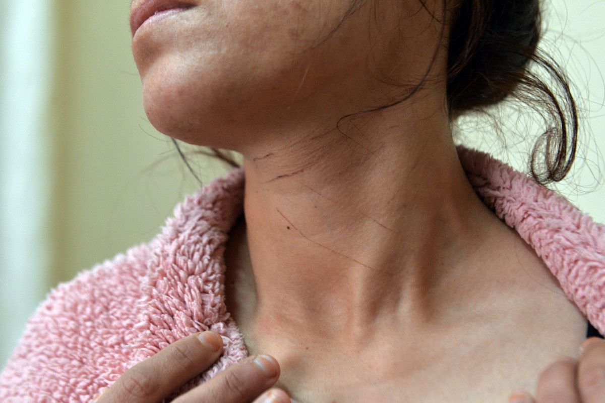 Adana'da Suriyeli Ceylan'ın hayatı kabusa döndü